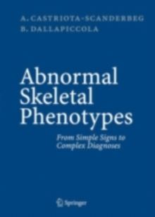 Image for Abnormal Skeletal Phenotypes: From Simple Signs to Complex Diagnoses