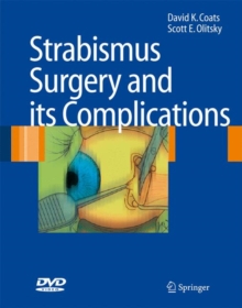 Image for Strabismus Surgery and Its Complications