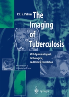 Image for The Imaging of Tuberculosis : With Epidemiological, Pathological and Clinical Correlation
