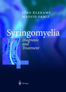 Image for Syringomyelia : Diagnosis and Treatment