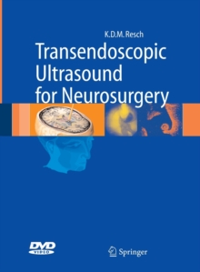 Image for Transendoscopic Ultrasound for Neurosurgery