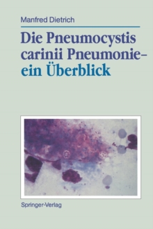 Image for Die Pneumocystis carinii Pneumonie— ein Uberblick