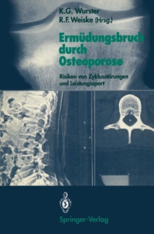 Image for Ermudungsbruch durch Osteoporose : Risiken von Zyklusstorungen und Leistungssport