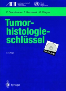 Image for Tumor-histologieschlussel : Empfehlungen zur aktuellen Klassifikation und Kodierung der Neoplasien auf der Grundlage der ICD-O