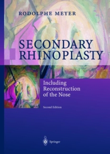 Image for Secondary Rhinoplasty : Including Reconstruction of the Nose
