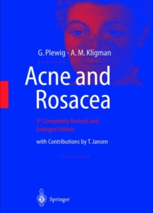 Image for Acne and Rosacea