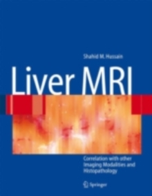 Image for Liver MRI: correlation with other imaging modalities and histopathology