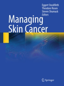 Image for Managing skin cancer