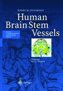 Image for Human Brain Stem Vessels