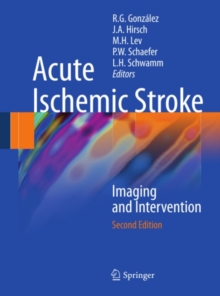 Image for Acute ischemic stroke
