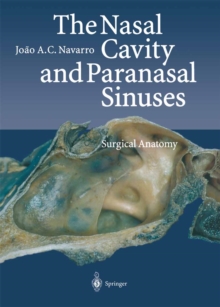 Image for Nasal Cavity and Paranasal Sinuses: Surgical Anatomy