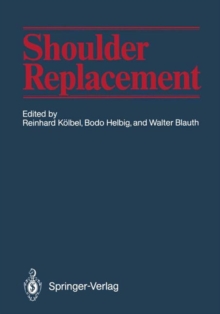 Image for Shoulder Replacement