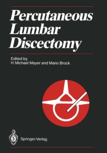 Image for Percutaneous Lumbar Discectomy