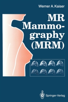 Image for MR Mammography (MRM)
