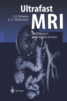 Image for Ultrafast MRI: techniques and applications