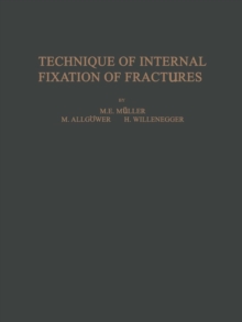 Image for Technique of Internal Fixation of Fractures