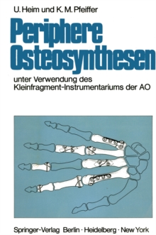 Image for Periphere Osteosynthesen: Unter Verwendung des Kleinfragment-Instrumentariums der AO