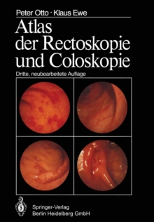 Image for Atlas der Rectoskopie und Coloskopie