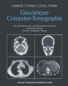 Ganzkorper-Computer-Tomographie