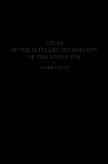 Image for Atlas of the Slitlamp-Microscopy of the Living Eye : Technic and Methods of Examination