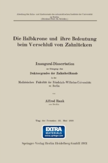 Image for Die Halbkrone und ihre Bedeutung beim Verschlu von Zahnlucken: Inaugural-Dissertation