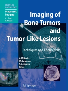 Image for Imaging of Bone Tumors and Tumor-Like Lesions : Techniques and Applications