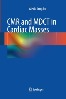 Image for CMR and MDCT in Cardiac Masses