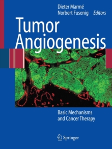 Image for Tumor Angiogenesis