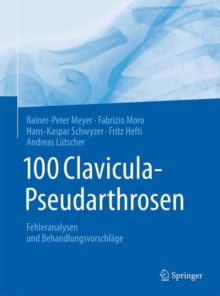 Image for 100 Clavicula-Pseudarthrosen