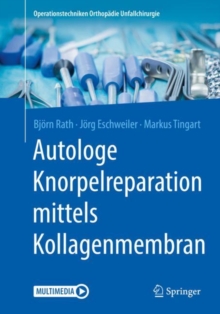 Image for Autologe Knorpelreparation mittels Kollagenmembran