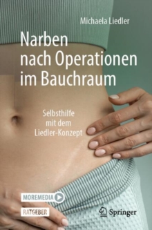 Image for Narben nach Operationen im Bauchraum