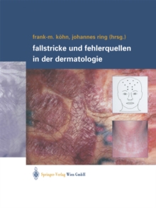 Image for Fallstricke und Fehlerquellen in der Dermatologie