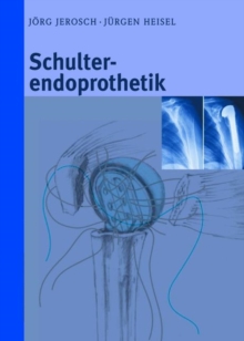 Image for Schulterendoprothetik