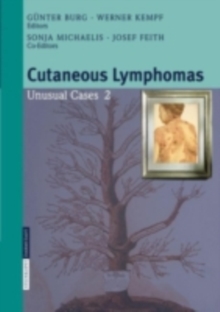 Image for Cutaneous Lymphomas: Unusual Cases 2