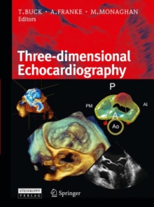 Image for 3D-echocardiography