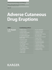 Image for Adverse Cutaneous Drug Eruptions