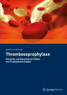 Image for Thromboseprophylaxe Klinische und okonomische Effekte von Prophylaxestrumpfen