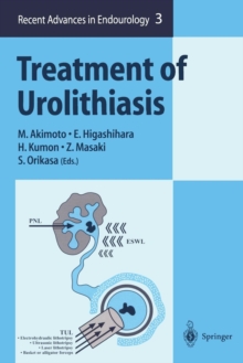 Image for Treatment of Urolithiasis