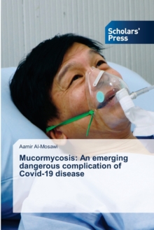 Image for Mucormycosis : An emerging dangerous complication of Covid-19 disease
