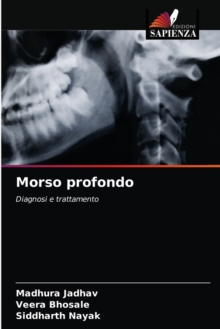 Image for Morso profondo