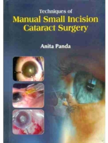 Techniques of Manual Small Incision Cataract Surgery