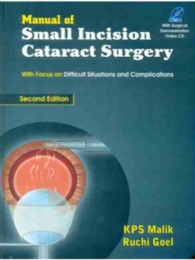 Manual of Small Incision Cataract Surgery