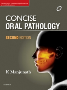 Image for Concise Oral Pathology