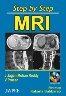 Image for Step by Step MRI