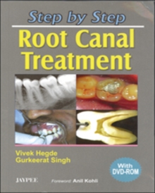 Image for Step by Step: Root Canal Treatment