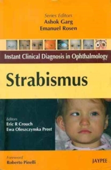 Image for Strabismus Instant Clinical Diagnosis in Ophthalmology
