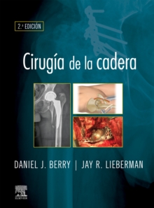Image for Cirugía De La Cadera