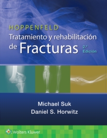 Hoppenfeld. Tratamiento y rehabilitacion de fracturas