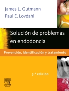 Image for Solucion de problemas en endodoncia: Prevencion, identificacion y tratamiento