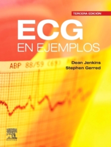 Image for ECG en ejemplos